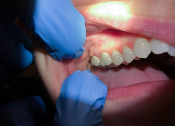 Best Emergency Cosmetic Dentistry in Hurlburt Field, FL